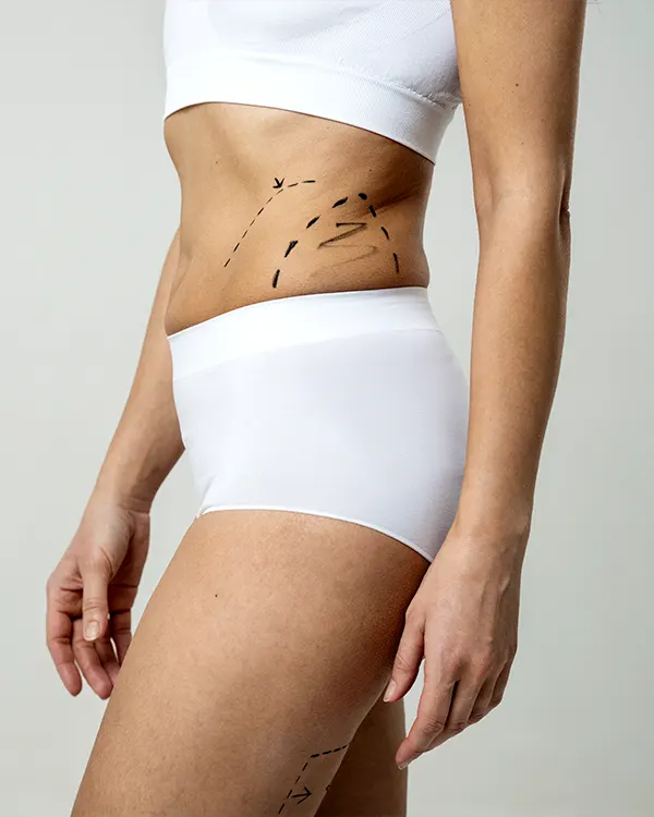 Img-Dr-Hector-García-Procedimientos-Corporales