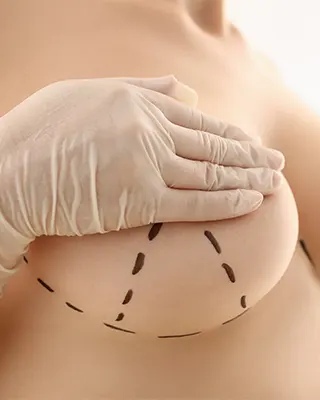 img-mastopexia-en-pereira-1-LCP